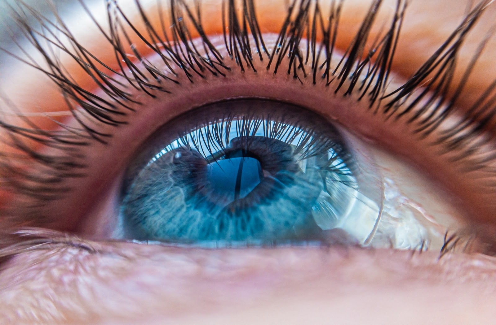 Close up of woman's eye wearing scleral contact lenses.