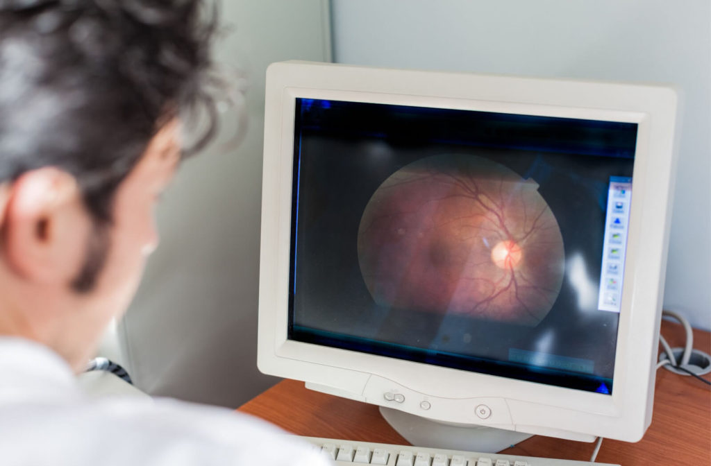 A male ophthalmologist looking at a retina scan on a computer monitor to assess the health of an eye.