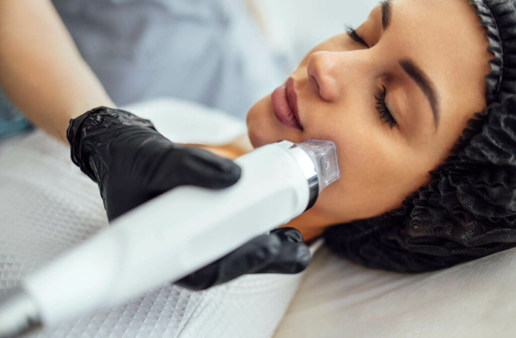 A woman undergoing RF Microneedling therapy