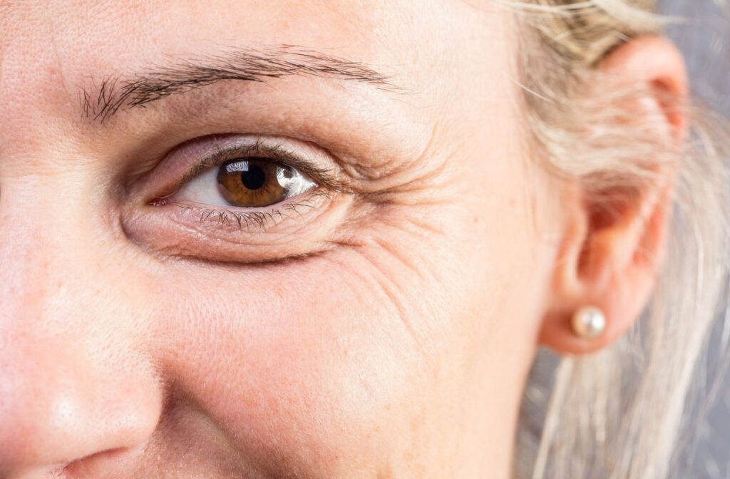 Close up of an eye with wrinkles on the surrounding skin
